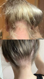 Сыворотка для роста волос — изображение 3