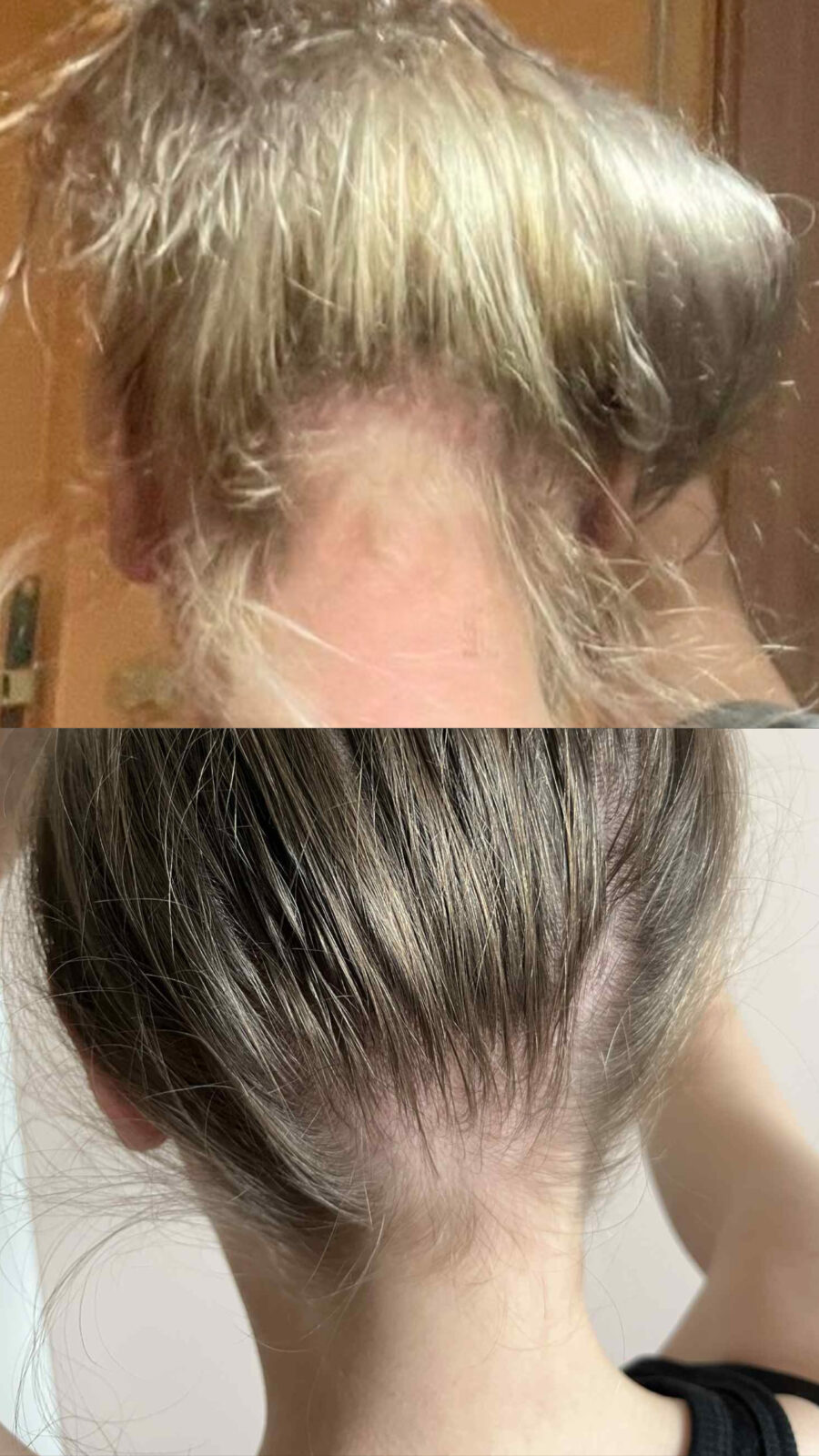 Сыворотка для роста волос — изображение 3