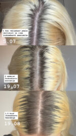 Сыворотка для роста волос — изображение 2