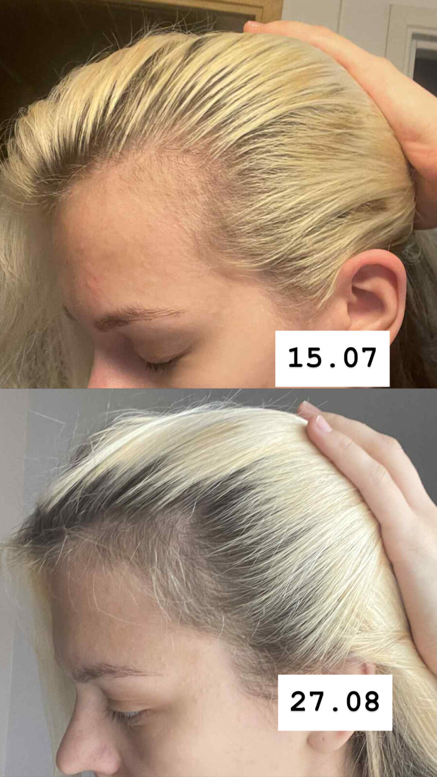 Сыворотка для роста волос — изображение 4